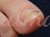 Титановий дріт для врослого нігтя №0,012'' (0.31мм) 10шт/уп - фотография товара. Купить с доставкой в интернет магазине Nailmag 3